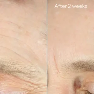 Hydration intense recovery cream / tratamiento reafirmante para el contorno de ojos 50ml