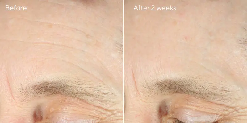Hydration intense recovery cream / tratamiento reafirmante para el contorno de ojos 50ml