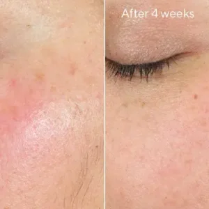 Hydration intense recovery cream / tratamiento reafirmante para el contorno de ojos 50ml