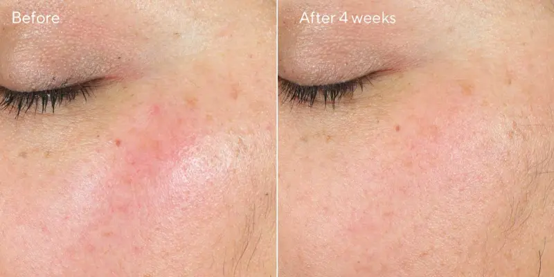Hydration intense recovery cream / tratamiento reafirmante para el contorno de ojos 50ml