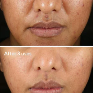 Rapid relief acne sulfur mask / mascarilla reparadora de hidratación celular 74ml