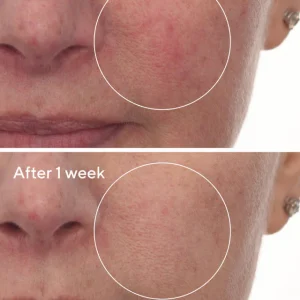 Cellular hydration repair serum / suero facial concentrado 30ml