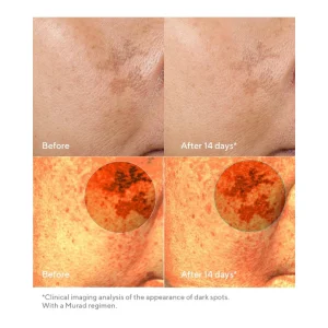 Rapid dark spot correcting serum / suero facial concentrado 30ml