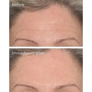 Targeted wrinkle corrector / corrector de ojeras con vitamina c
