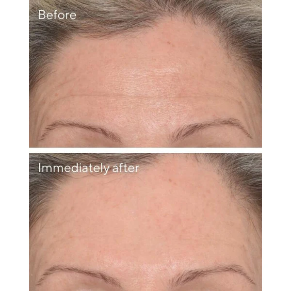 Targeted wrinkle corrector / corrector de ojeras con vitamina c