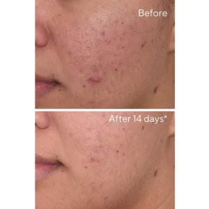 Rapid dark spot correcting serum / suero facial concentrado 30ml