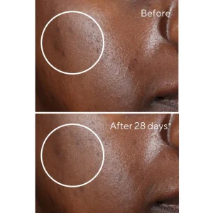 Rapid dark spot correcting serum / suero facial concentrado 30ml