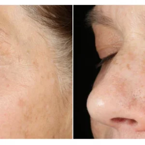 Vita-c triple exfoliating facial / tratamiento facial de murad