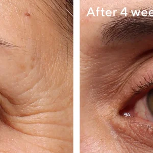 Retinol youth renewal eye serum / tratamiento reafirmante para el contorno de ojos