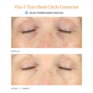 Vita-c eyes dark circle corrector / tratamiento reafirmante para el contorno de ojos 15ml