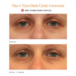 Vita-c eyes dark circle corrector / tratamiento reafirmante para el contorno de ojos 15ml