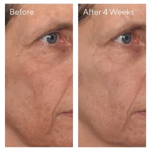 Vita-C Glycolic Brightening serum / suero glicólico con vitamina C 30ml