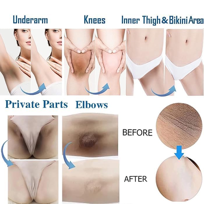 Skin Lightening Cream Gel For Body Intimate Area With Niacinamide, Arbutin, Vitamin C For Private Parts, Underarm, Knees, Elbows, Inner Thigh, Bikini Areas, armpit Skin Whitening Bleaching Cream 30ML