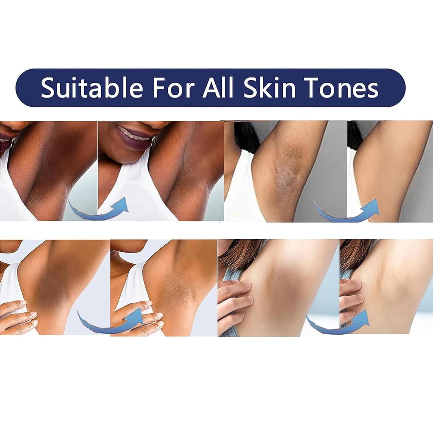 Skin Lightening Cream Gel For Body Intimate Area With Niacinamide, Arbutin, Vitamin C For Private Parts, Underarm, Knees, Elbows, Inner Thigh, Bikini Areas, armpit Skin Whitening Bleaching Cream 30ML