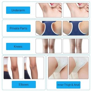 Skin Lightening Cream Gel For Body Intimate Area With Niacinamide, Arbutin, Vitamin C For Private Parts, Underarm, Knees, Elbows, Inner Thigh, Bikini Areas, armpit Skin Whitening Bleaching Cream 30ML