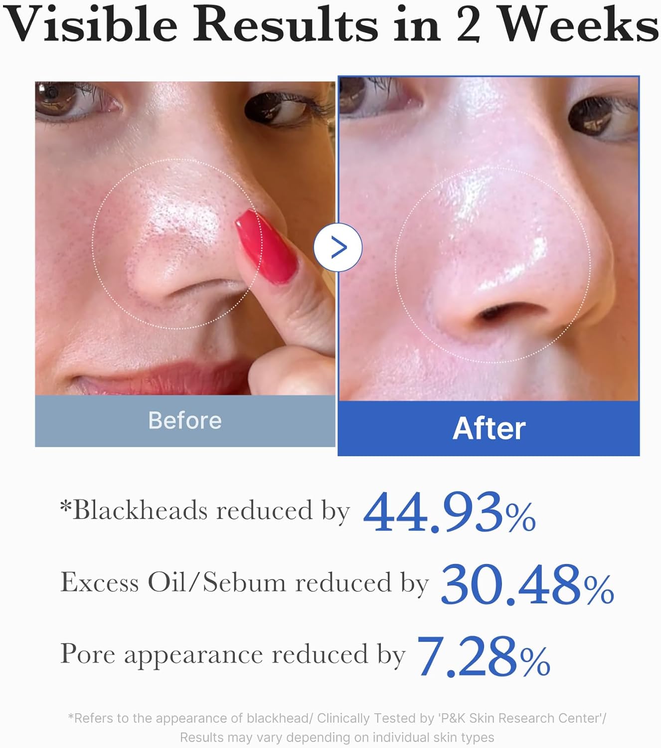 medicube Almohadillas de tóner Zero Pore Pad 2.0 | Almohadilla facial de doble textura para exfoliación y cuidado de poros con 4.5% de ácido láctico AHA, 0.45% ácido salicílico BHA | Ideal para todos, cuidado de la piel coreano, 70 almohadillas (1 paquete)