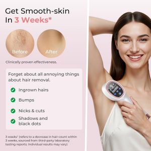 Ubroo IPL Laser Hair Removal Device - 41°F Ice Cooling Painless Laser for Women Men, Face Body Bikini, 21J Energy, 96% Hair Reduction, At-Home Professional Results