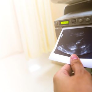 UPP-110HD High Density Printing Paper - Box of 10 Rolls