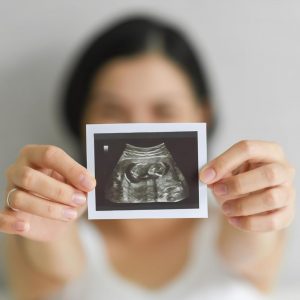 UPP-110HD High Density Printing Paper - Box of 10 Rolls