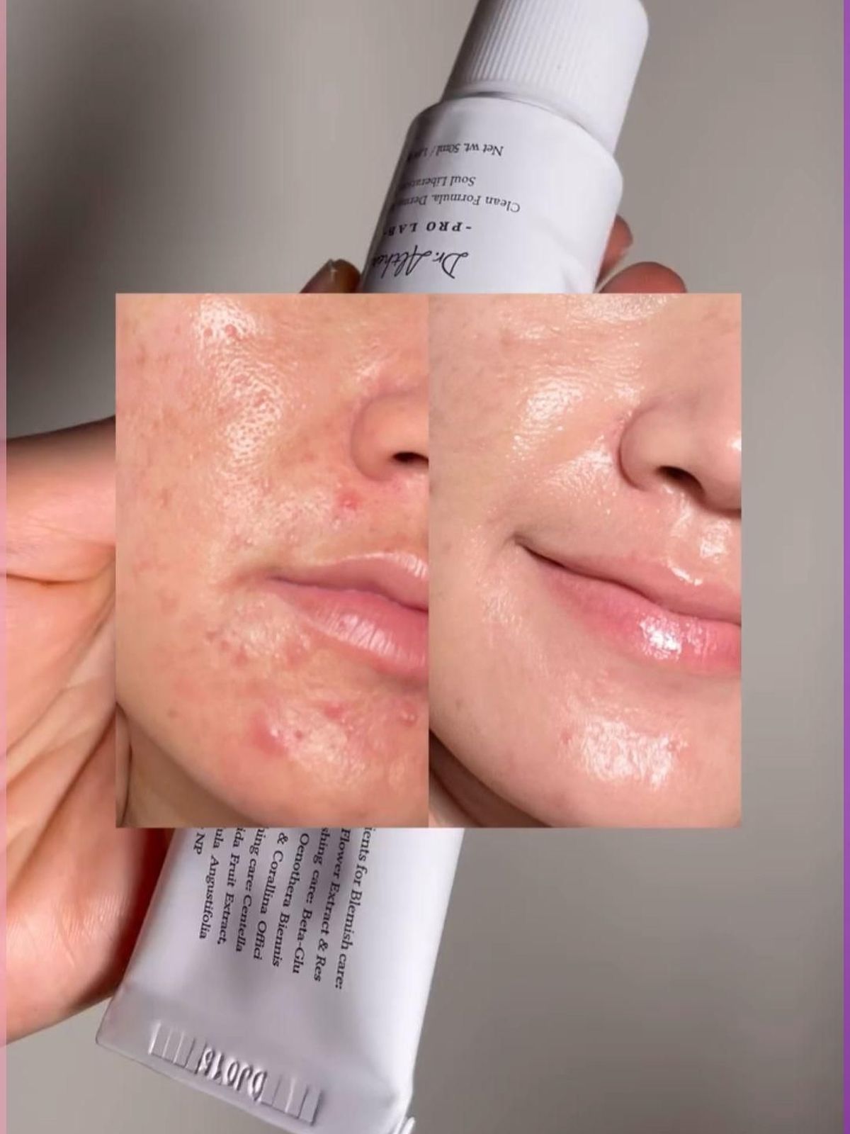 Dr. Althea 345 Relief Cream