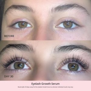ForChics Eyelash Growth Serum - Prostaglandin-Free Lash Enhancing Serum for Longer, Thicker Lashes and Brows- Natural Formula, Visible Results in 2 Weeks - Vegan, Hormone-Free 0.10 fl. oz / 3ml