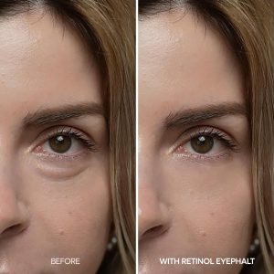 Dr.Melaxin Crema de ojos de retinol para hinchazón, ojeras y líneas finas, arrugas, EGF Anti-envejecimiento debajo de los ojos hidratante con niacinamida y ceramida Cuidado de la piel coreano amigable con el maquillaje