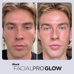 Shark FacialPro Glow en casa Sistema facial con tecnología hidráulica con terapia DePuffi caliente y frío - Dispositivo profesional de cuidado de la piel de spa para limpieza de poros, hidratación y
