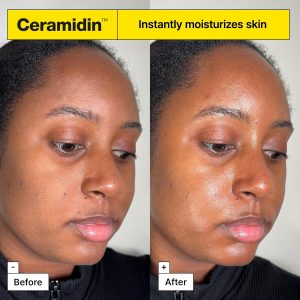 Dr.Jart+ Ceramidin Skin Barrier Korean Face Cream Moisturizer with Ceramides and Panthenol | Korean Skin Care