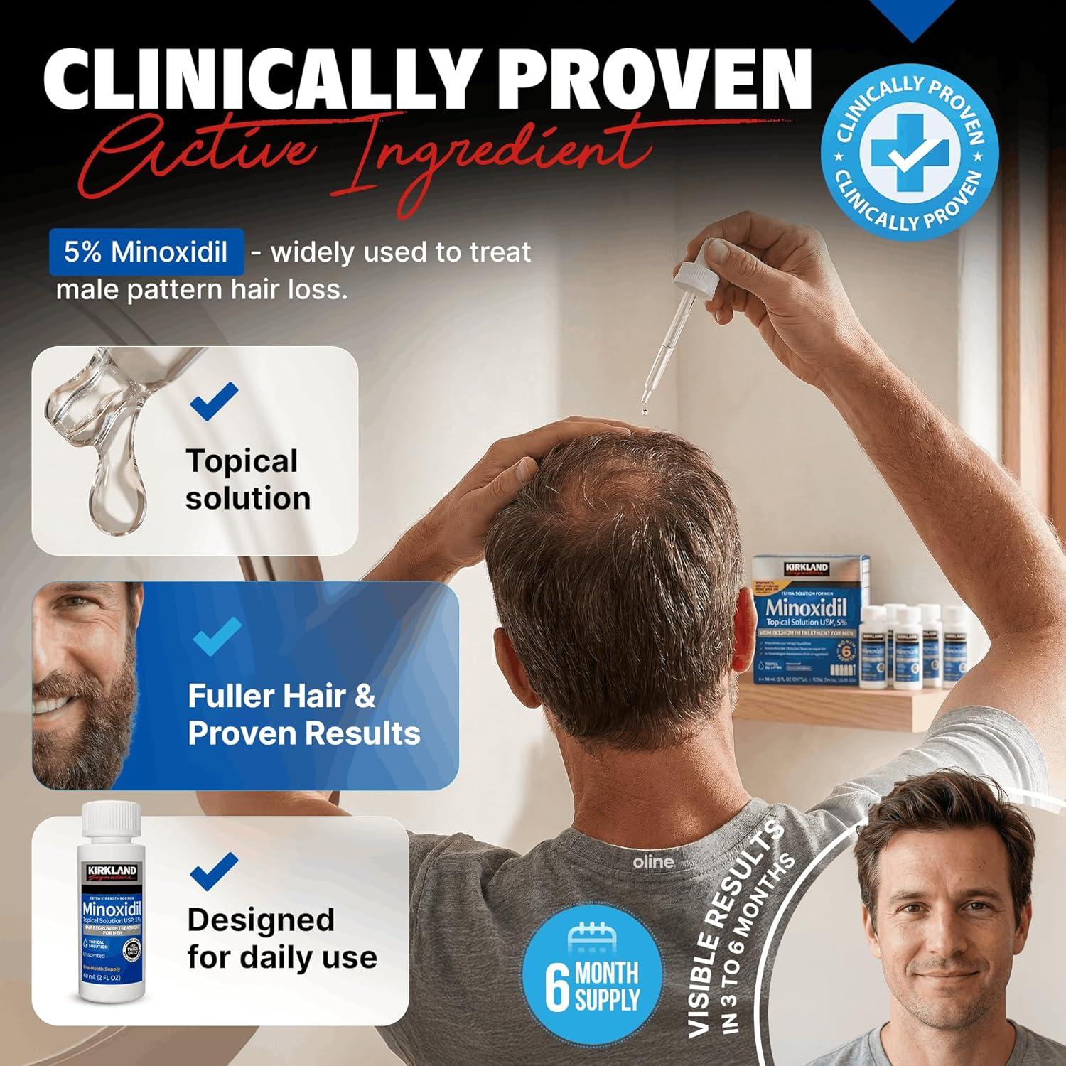 Kirkland Signature Minoxidil Solución tópica USP 5%, tratamiento de crecimiento capilar extra fuerte para hombres, suministro de 6 meses