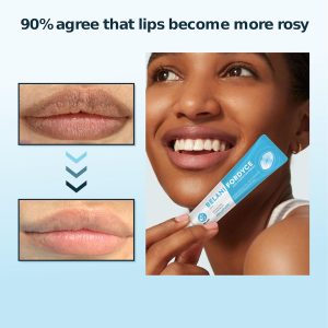 Crema Belani Fordyce – Ayuda a reducir las manchas de Fordyce, cuidado labial hidratante diario para labios secos, agrietados y sensibles a la oscuridad con aceite de girasol, extracto de loto y manteca de karité (0.7 onzas)