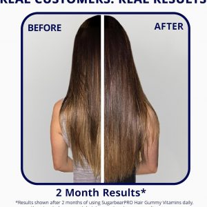 SugarBearPro Hair Vitamin Gummy 6 Month Supply Extra Strength Biotin 6000mcg, Growth for Men & Women, Vegan Vitamin B12, MSM, Inositol, Omega 3, Elderberry, Certified Kosher, Halal, Cruelty-Free
