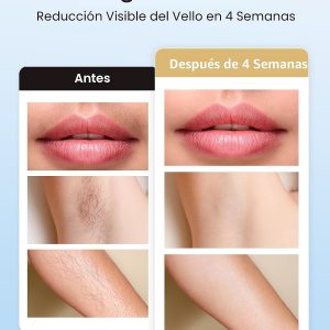 INNZA Depilación láser con función de cuidado de enfriamiento por hielo para mujeres, permanente, 999,999 destellos sin dolor IPL, dispositivo de depilación para axilas, piernas, brazos, línea de bikini (oro rosa)