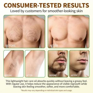 Uocasi Cyperus Rotundus Oil, Cypress Rotundus Oil for Hair Removal, Natural Inhibitor to Reduce Unwanted Hair Growth, Soothes Skin & Minimizes Pores, All Skin Types, 2.02 Oz